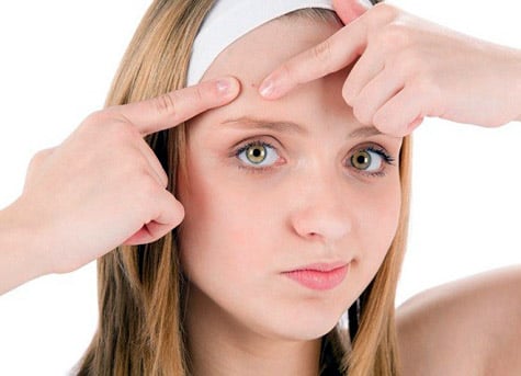 Cách trị mụn trứng cá an toàn hiệu quả