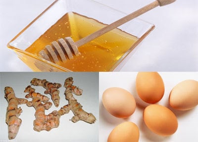 mẹo làm mờ vết rạn sau sinh