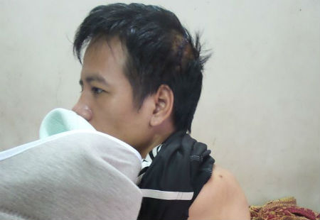 Mô tả ảnh.