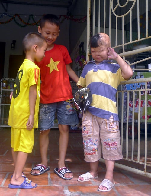 Cháu bé bị bố tưới xăng đốt suýt chết, mẹ bị gạ tình ước mơ làm bác sĩ