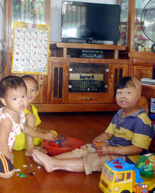 Cháu bé bị bố tưới xăng đốt suýt chết, mẹ bị gạ tình ước mơ làm bác sĩ