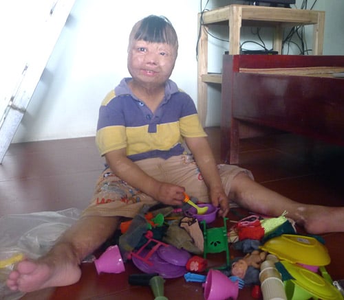 Cháu bé bị bố tưới xăng đốt suýt chết, mẹ bị gạ tình ước mơ làm bác sĩ