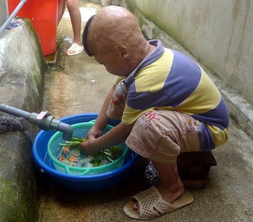 Cháu bé bị bố tưới xăng đốt suýt chết, mẹ bị gạ tình ước mơ làm bác sĩ