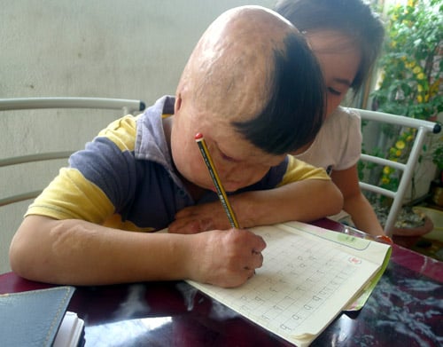 Cháu bé bị bố tưới xăng đốt suýt chết, mẹ bị gạ tình ước mơ làm bác sĩ