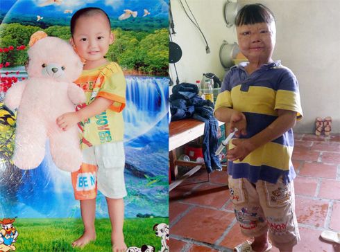 Vụ cha đốt con, mẹ bị thẩm phán gạ tình ở Thanh Hoá