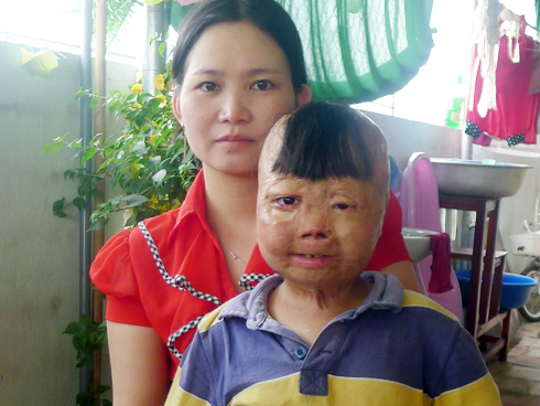 Vụ cha đốt con, mẹ bị thẩm phán gạ tình ở Thanh Hoá