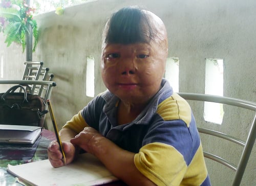 Cháu bé bị bố tưới xăng đốt, mẹ bị thẩm phán gạ tình mơ làm bác sĩ