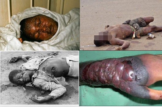 Ebola, virut ebola, đại dịch ebola, đại dịch, bệnh truyền nhiễm, sức khỏe