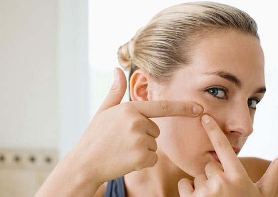 Lý do khiến bạn luôn bị mụn trứng cá
