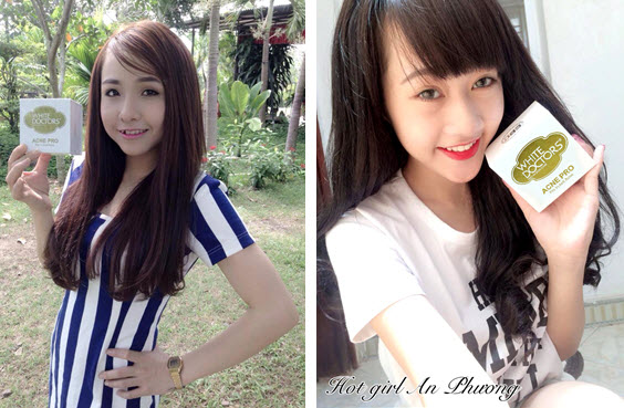 Mô tả ảnh.