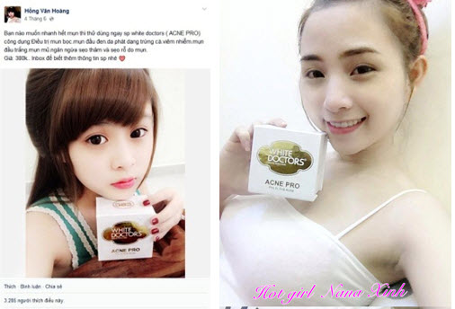 Mô tả ảnh.