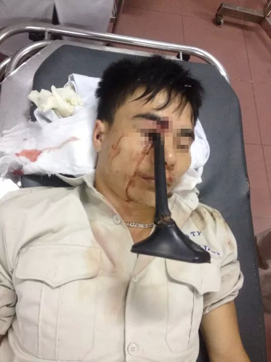 tai nạn, ô tô, xe máy, nạn nhân, bệnh viện, bệnh viện Việt - Đức, Hà Nội, bệnh viện Việt Đức - Hà Nội