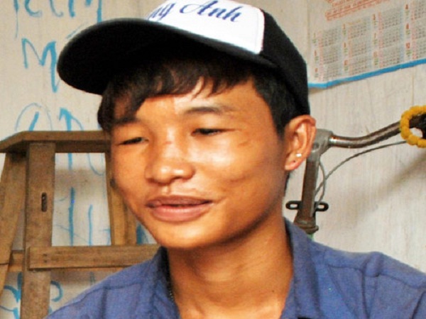 Mô tả ảnh.