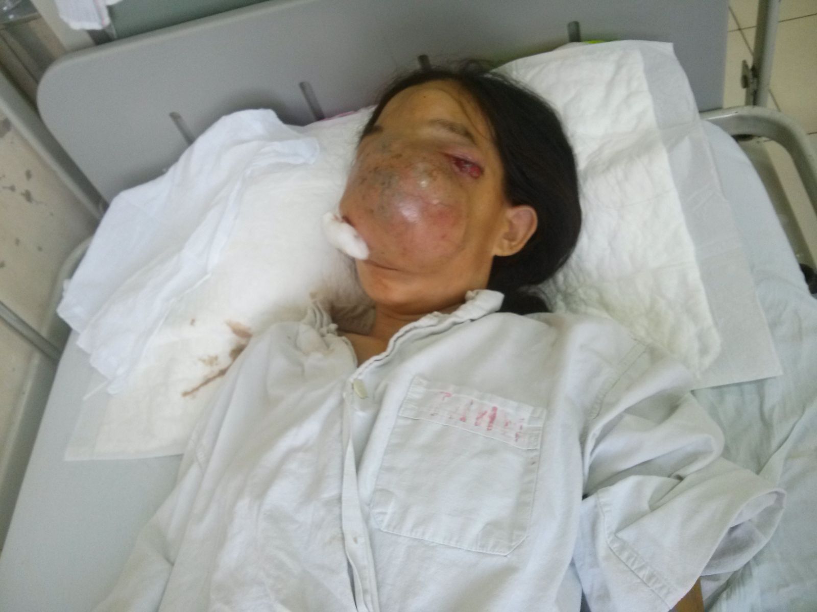 người đàn bà mang gương mặt quỷ