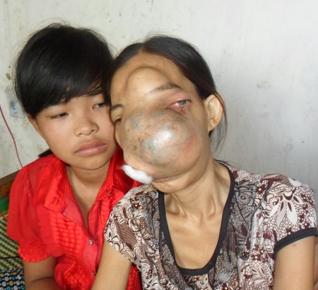 người đàn bà mang gương mặt quỷ