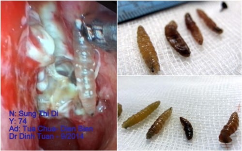 sức khỏe, chữa bệnh, bệnh lạ, có thể bạn chưa biết, viêm xoang