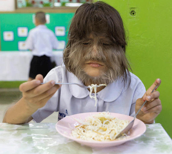 dị nhân