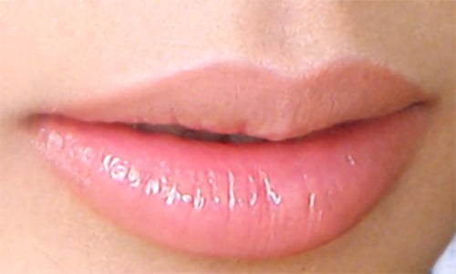 Cách trị môi thâm