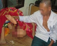 nguyễn anh tú