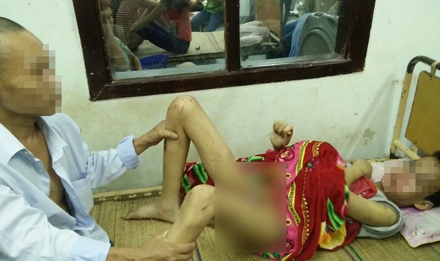 bé trai tàn tật bị bạo hành