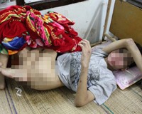 bé trai tàn tật bị xâm hại