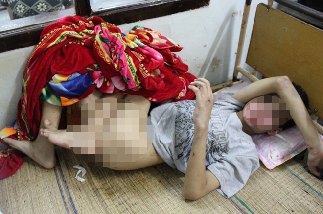bé trai tàn tật bị bạo hành