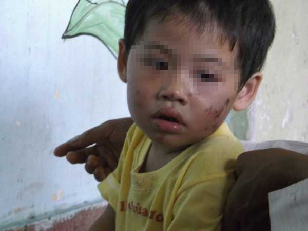 bé gái bị nhét bvs vào mồm