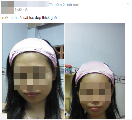 Mô tả ảnh.