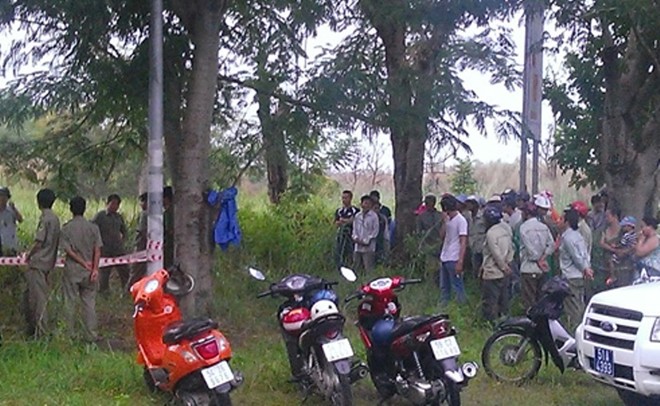 xương người