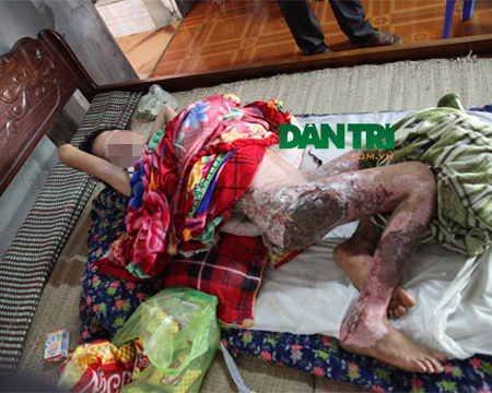 mẹ đẩy con vào đống lửa