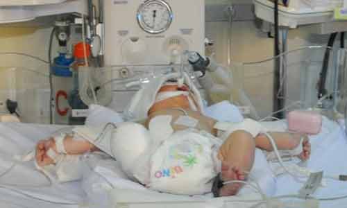 thai nhi bị văng khỏi bụng mẹ