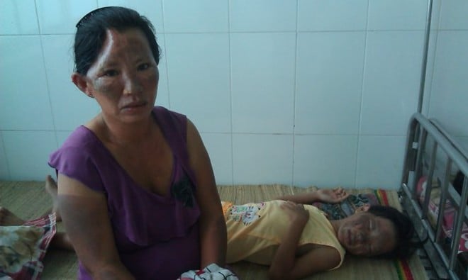 nổ bếp ga mini