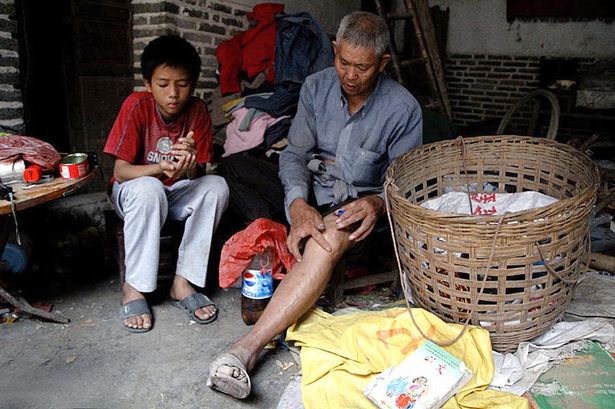 Mô tả ảnh.