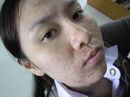 hỏng mặt