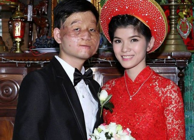 Mô tả ảnh.