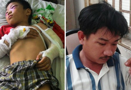 Chân dung cha dượng hờ và bé Hiếu đang cấp cứu tai bệnh viện 