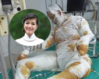 bỏng cồn