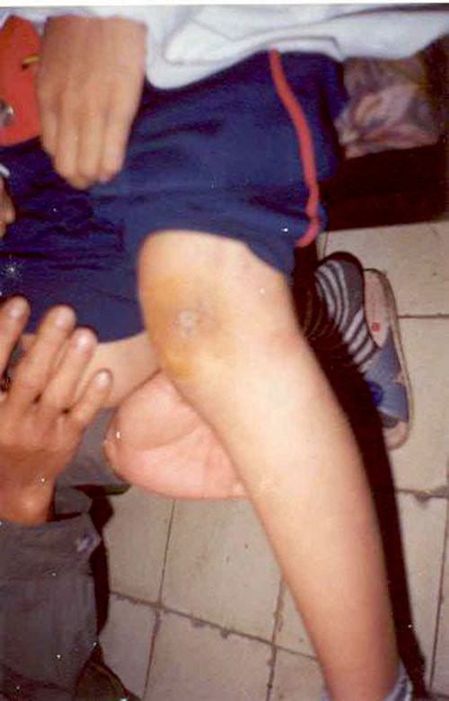 Mô tả ảnh.
