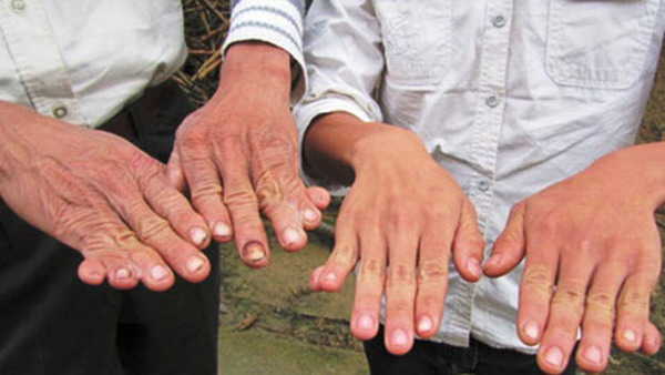 Mô tả ảnh.