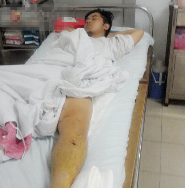 Mô tả ảnh.