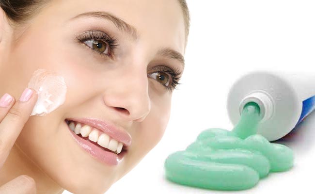 trị mụn bằng kem đánh răng