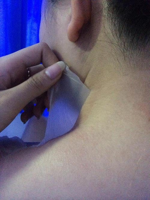 lột da
