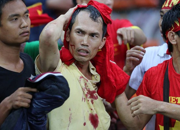 Mô tả ảnh.