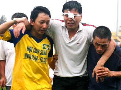 Mô tả ảnh.