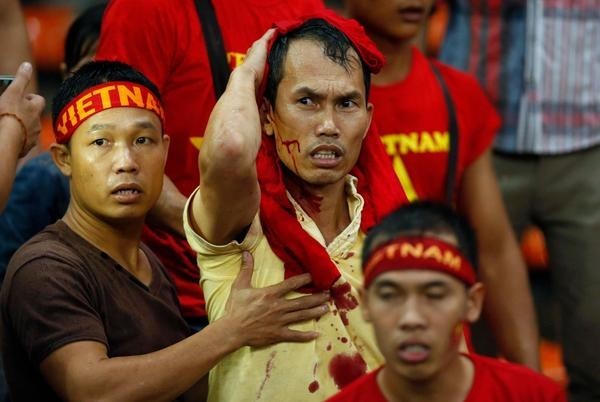 Mô tả ảnh.