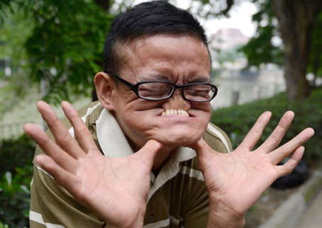 Mô tả ảnh.