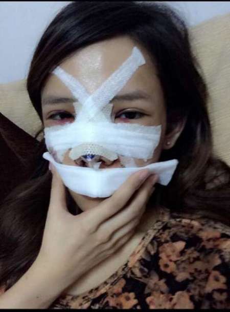 Mô tả ảnh.