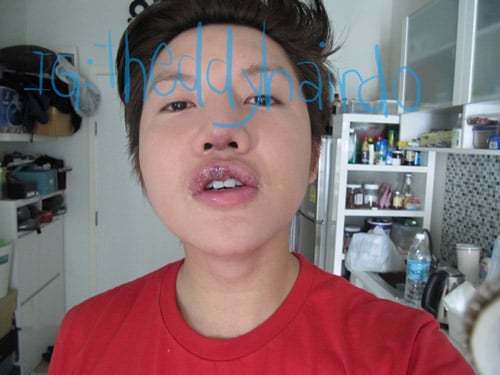 thẩm mỹ