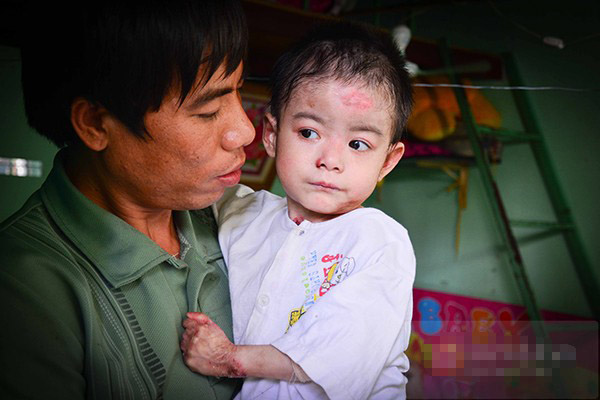 Mô tả ảnh.
