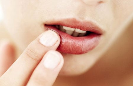 ngừa môi chảy máu